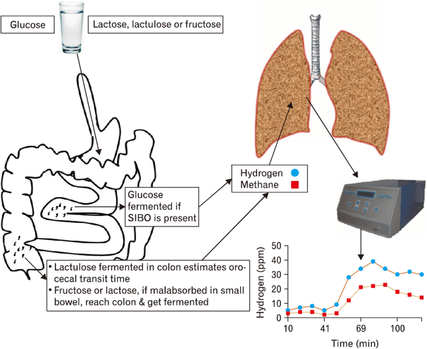 Diagram that shows the principle of hydrogen breath test