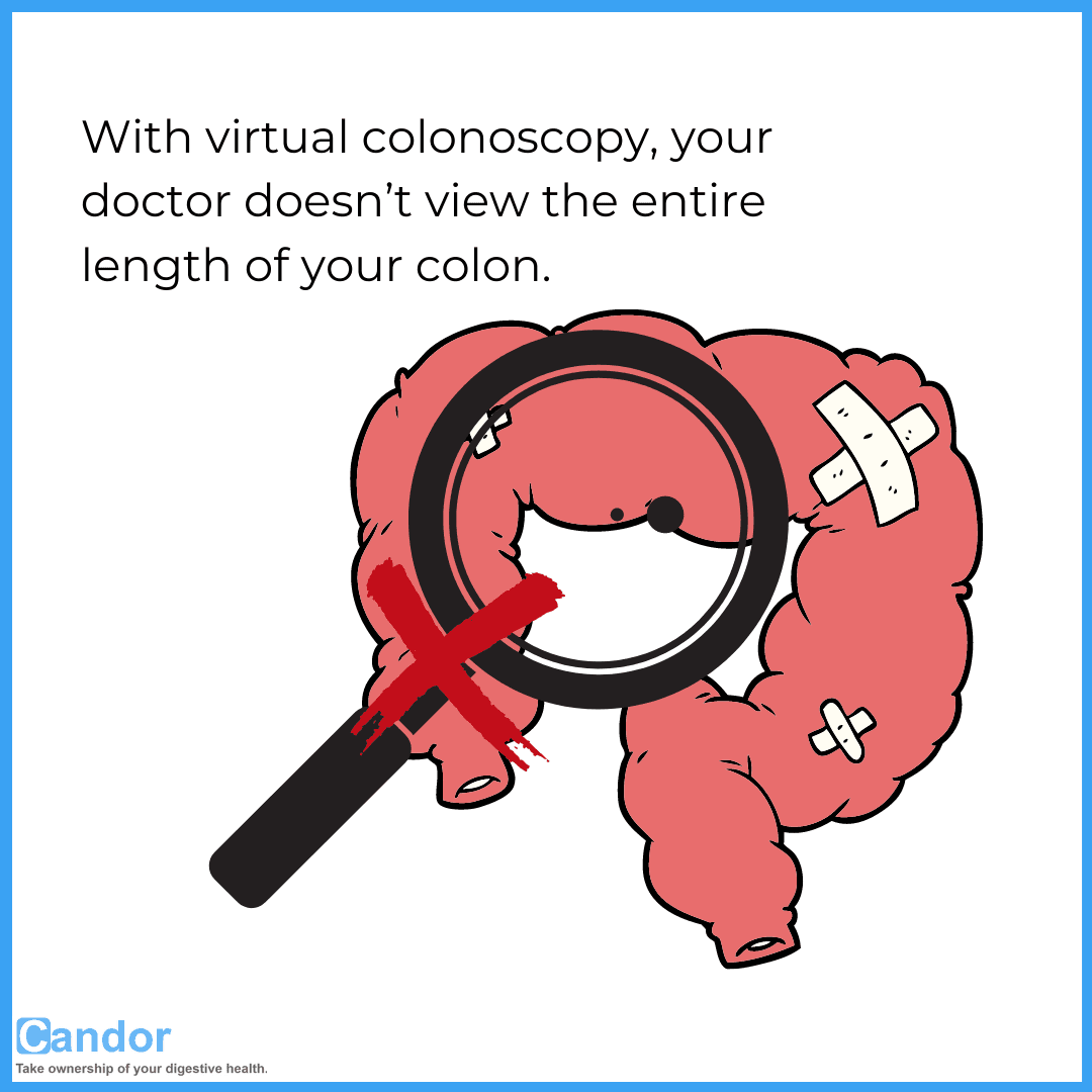How is Virtual Colonoscopy different from Colonoscopy? Candor
