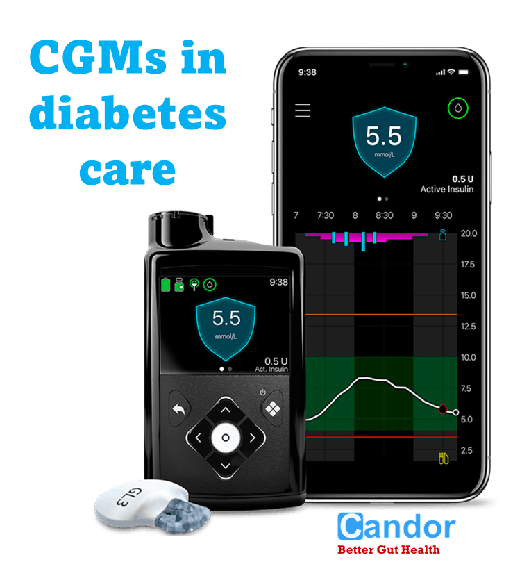 Understanding CGMs in diabetes care Candor