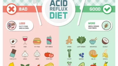 gerd diet candor