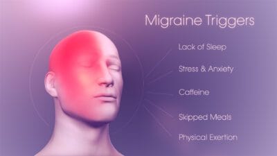 migraine triggers candor